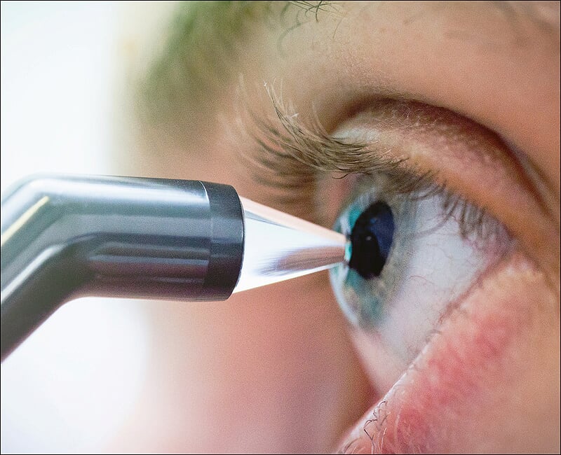 Методы проведения пахиметрии глаза